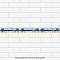 Captain Beachy 2" x 7-7/8" Ceramic Wall Trim Tile - Sold by the individual piece